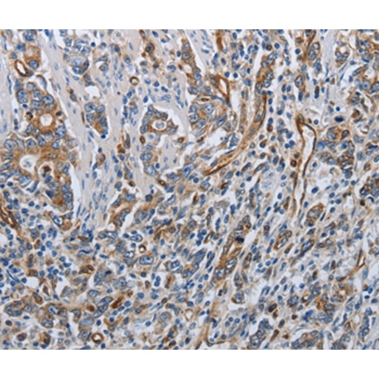 Immunohistochemistry - SOCS1 Antibody from Signalway Antibody (37038) - Antibodies.com