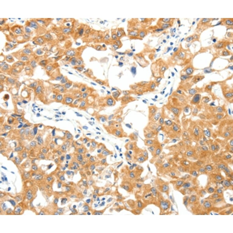 Immunohistochemistry - TRAF3 Antibody from Signalway Antibody (37053) - Antibodies.com