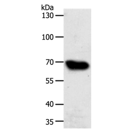 ABCG1 Antibody from Signalway Antibody (37074) - Antibodies.com