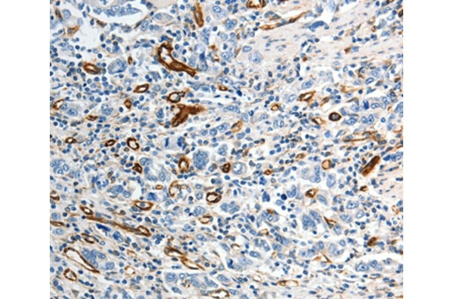 Immunohistochemistry - ABCG1 Antibody from Signalway Antibody (37074) - Antibodies.com