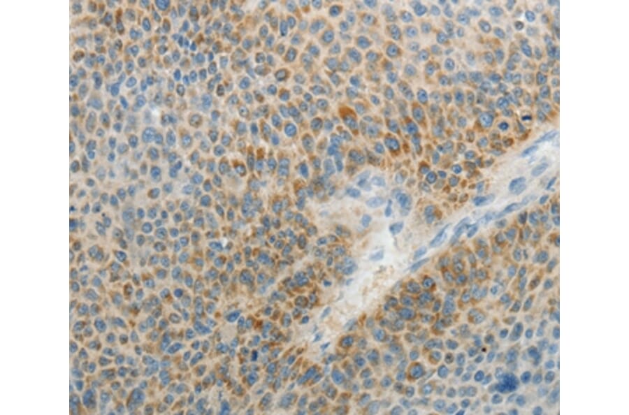 Immunohistochemistry - AGAP1 Antibody from Signalway Antibody (37088) - Antibodies.com