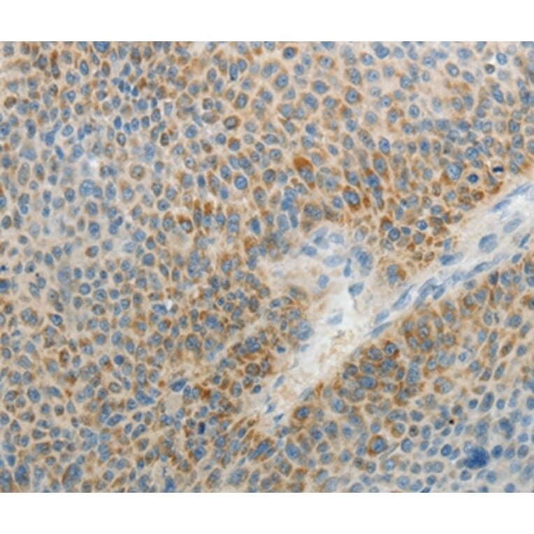 Immunohistochemistry - AGAP1 Antibody from Signalway Antibody (37088) - Antibodies.com