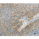 Immunohistochemistry - AGAP1 Antibody from Signalway Antibody (37088) - Antibodies.com