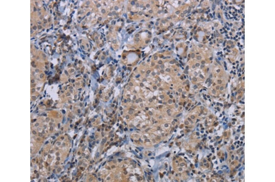 Immunohistochemistry - CDC16 Antibody from Signalway Antibody (37111) - Antibodies.com