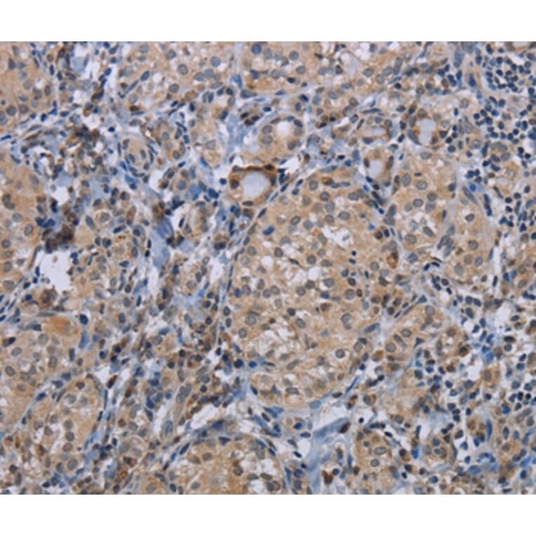 Immunohistochemistry - CDC16 Antibody from Signalway Antibody (37111) - Antibodies.com