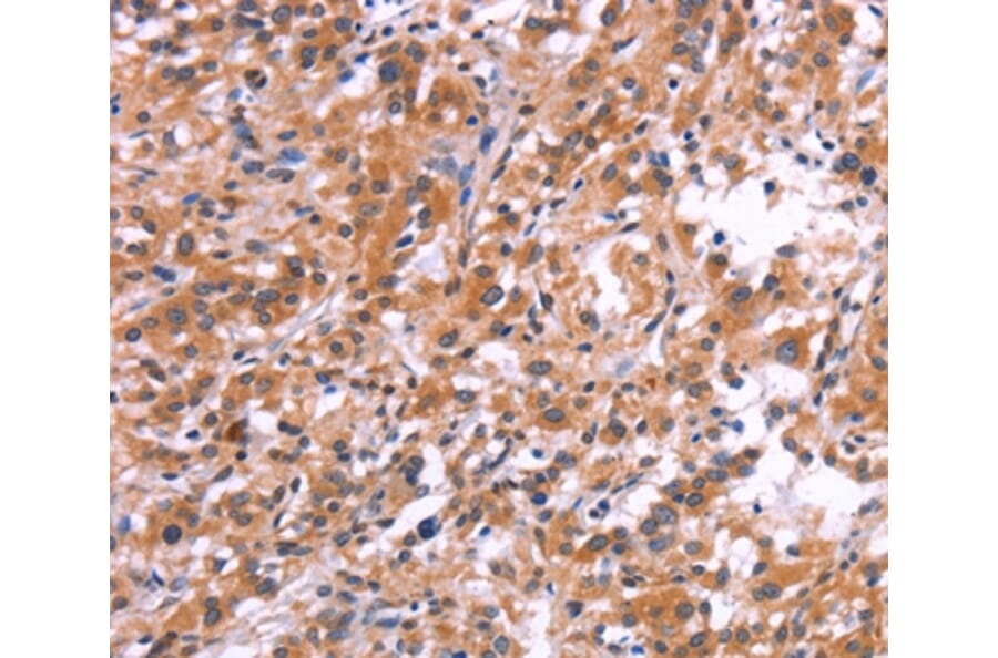 Immunohistochemistry - APMAP Antibody from Signalway Antibody (37112) - Antibodies.com