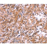 Immunohistochemistry - APMAP Antibody from Signalway Antibody (37112) - Antibodies.com