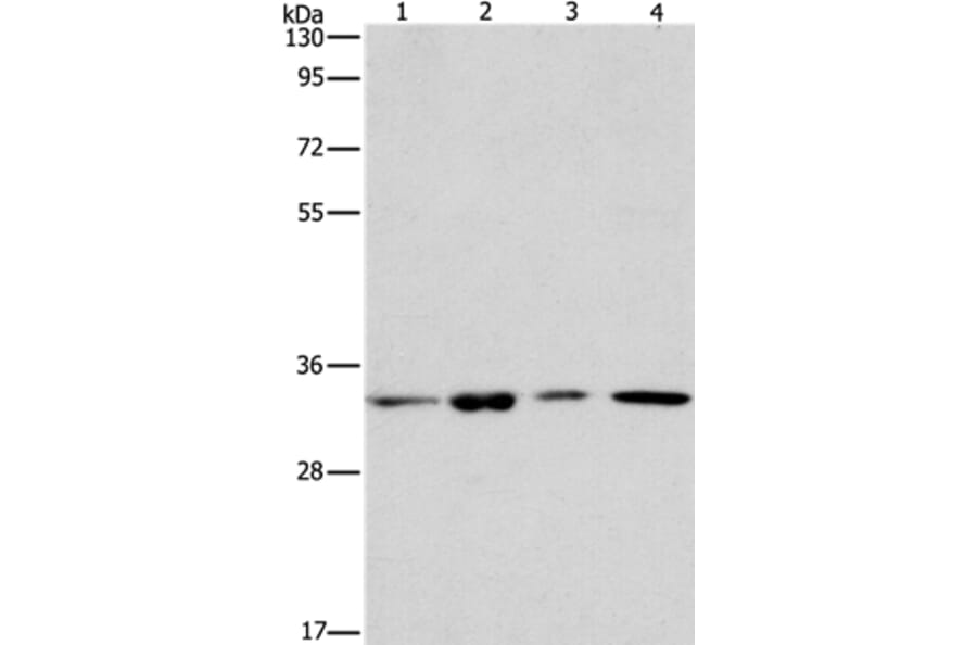 ARPC2 Antibody from Signalway Antibody (37115) - Antibodies.com