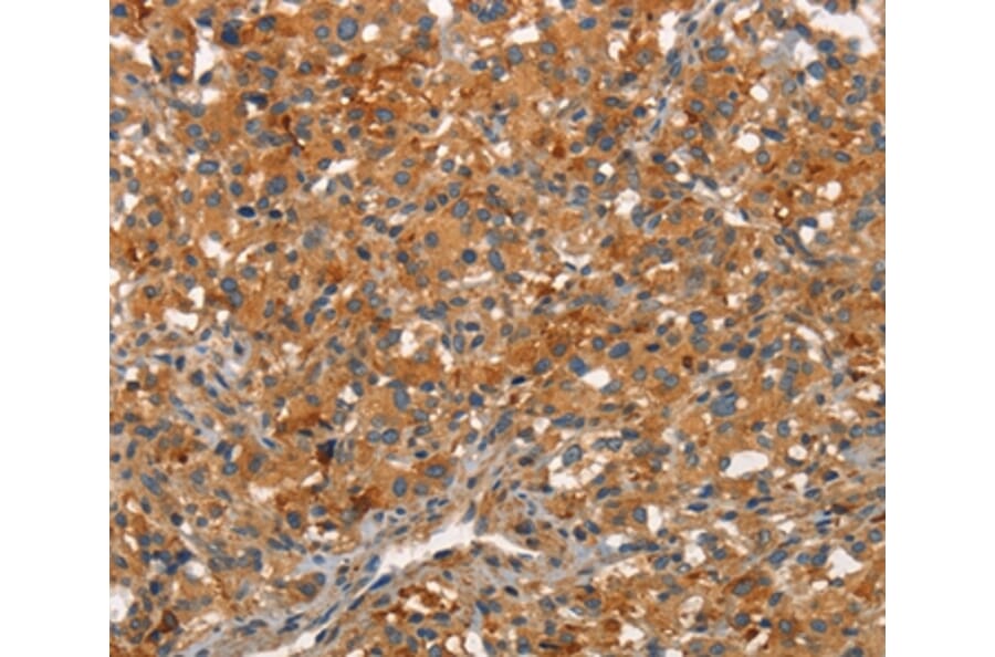 Immunohistochemistry - ARPC2 Antibody from Signalway Antibody (37115) - Antibodies.com
