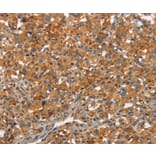 Immunohistochemistry - ARPC2 Antibody from Signalway Antibody (37115) - Antibodies.com