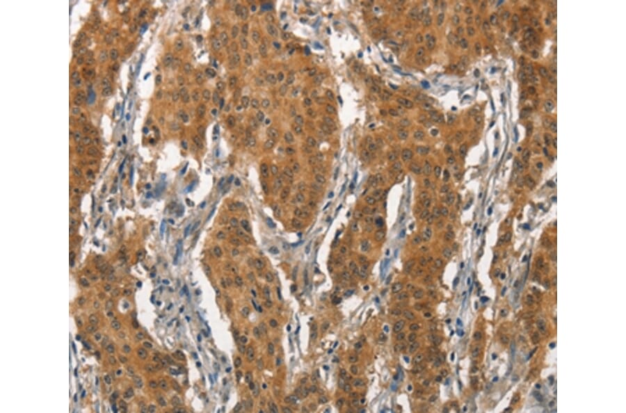 Immunohistochemistry - ITGA2 Antibody from Signalway Antibody (37117) - Antibodies.com