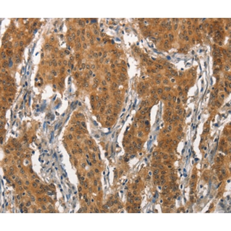 Immunohistochemistry - ITGA2 Antibody from Signalway Antibody (37117) - Antibodies.com