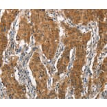 Immunohistochemistry - ITGA2 Antibody from Signalway Antibody (37117) - Antibodies.com