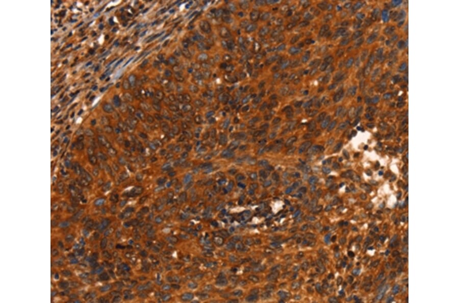Immunohistochemistry - PRKD1 Antibody from Signalway Antibody (37125) - Antibodies.com