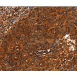 Immunohistochemistry - PRKD1 Antibody from Signalway Antibody (37125) - Antibodies.com