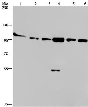 Gel: 6%SDS-PAGE Lysates (from left to right): Human testis tissue, K562, A549, Raji, NIH/3T3 and Hela cell Amount of lysate: 40ug per lane Primary antibody: 1/200 dilution Secondary antibody dilution: 1/8000 Exposure time: 10 minutes