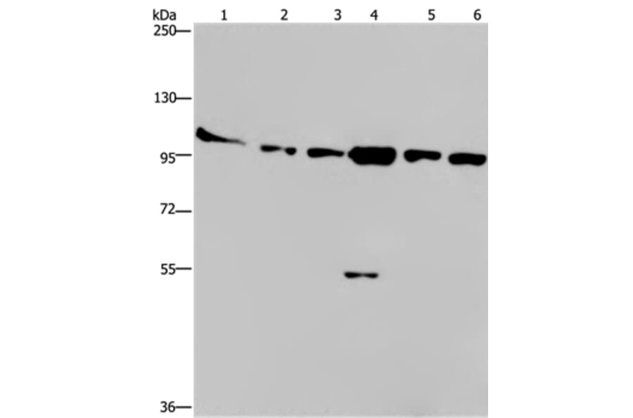 PRKD3 Antibody from Signalway Antibody (37126) - Antibodies.com