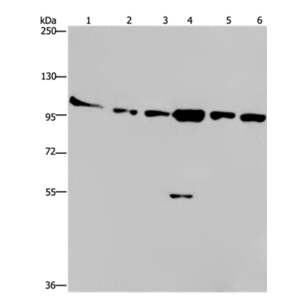 PRKD3 Antibody from Signalway Antibody (37126) - Antibodies.com