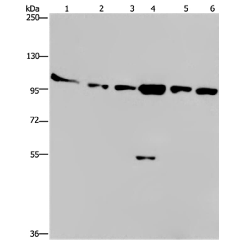 PRKD3 Antibody from Signalway Antibody (37126) - Antibodies.com