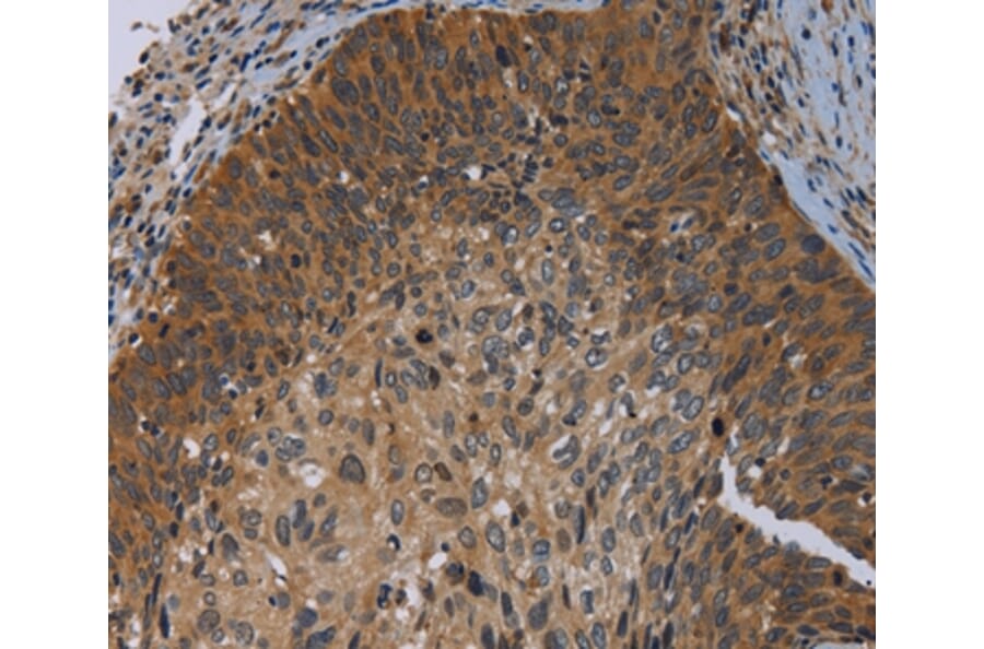 Immunohistochemistry - PRKD3 Antibody from Signalway Antibody (37126) - Antibodies.com