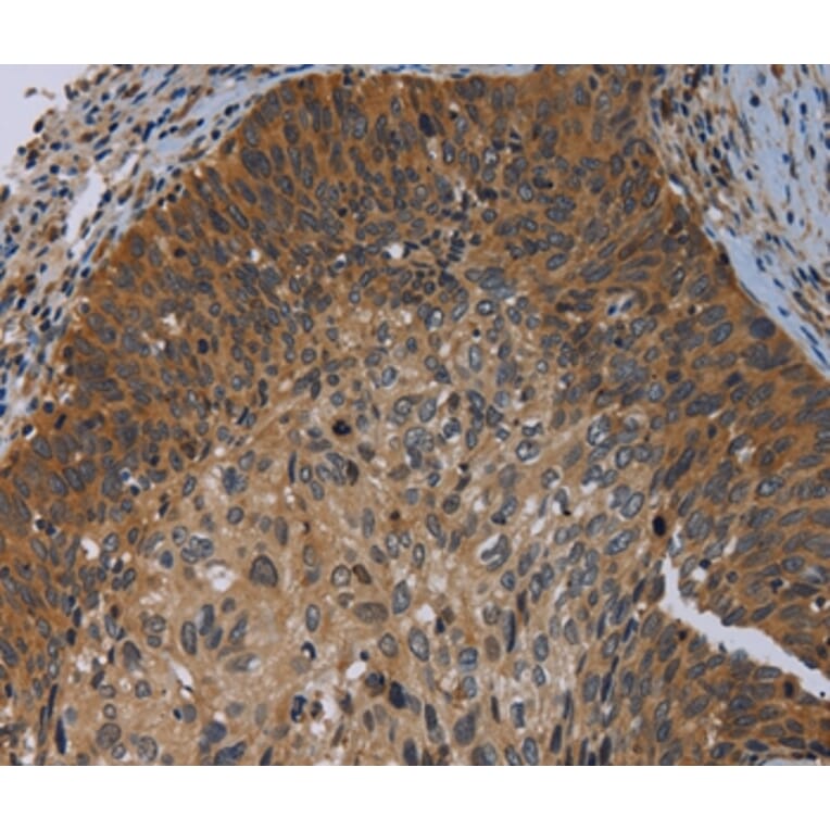 Immunohistochemistry - PRKD3 Antibody from Signalway Antibody (37126) - Antibodies.com