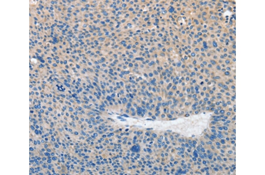Immunohistochemistry - PRKG2 Antibody from Signalway Antibody (37137) - Antibodies.com