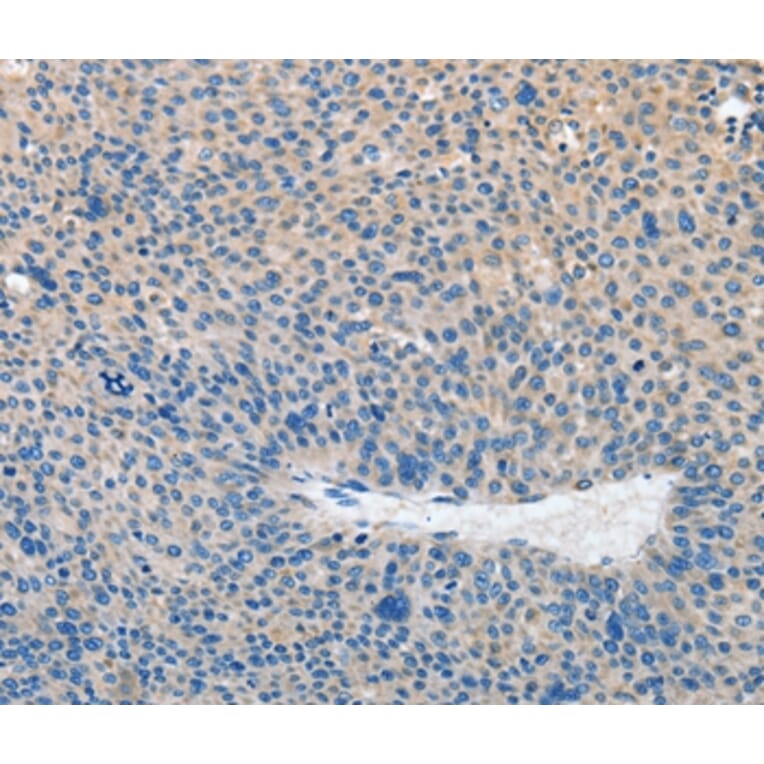 Immunohistochemistry - PRKG2 Antibody from Signalway Antibody (37137) - Antibodies.com
