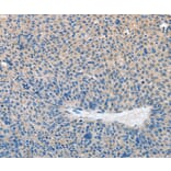 Immunohistochemistry - PRKG2 Antibody from Signalway Antibody (37137) - Antibodies.com