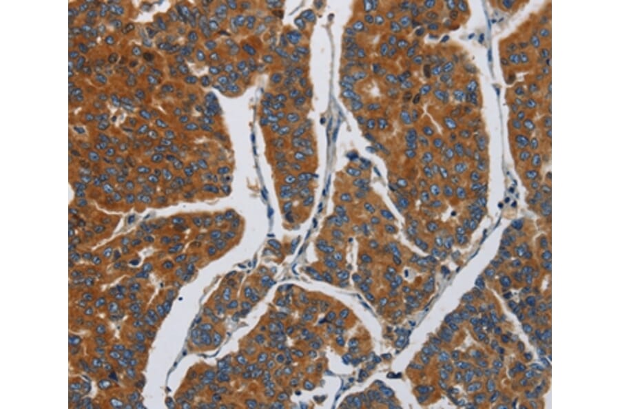 Immunohistochemistry - APEH Antibody from Signalway Antibody (37141) - Antibodies.com