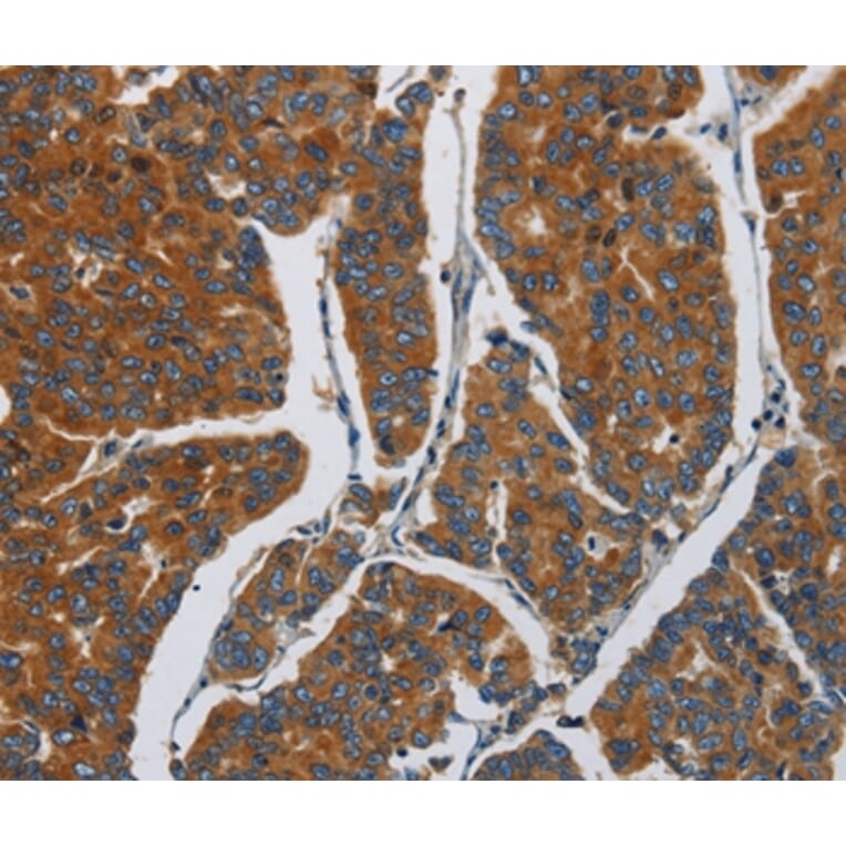 Immunohistochemistry - APEH Antibody from Signalway Antibody (37141) - Antibodies.com