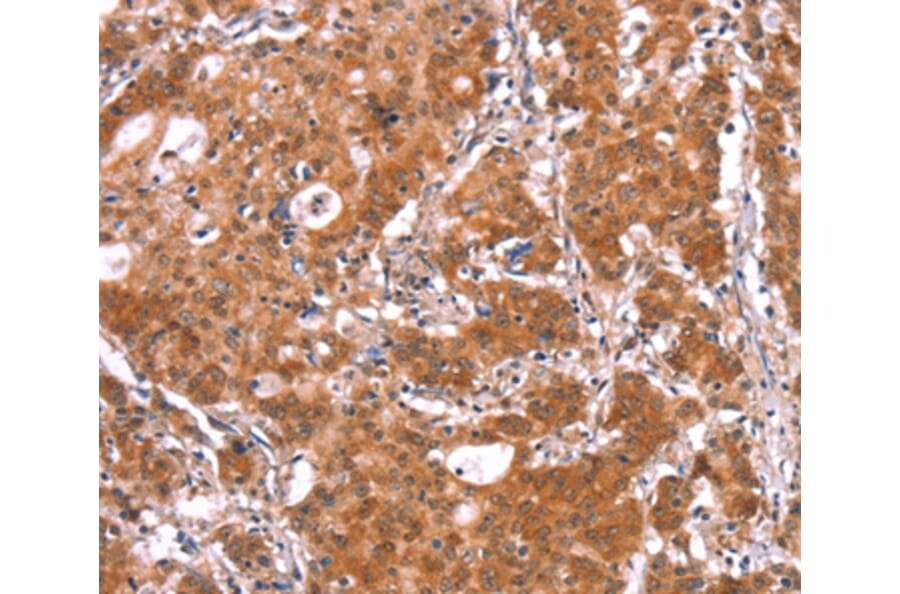 Immunohistochemistry - BCAR1 Antibody from Signalway Antibody (37147) - Antibodies.com