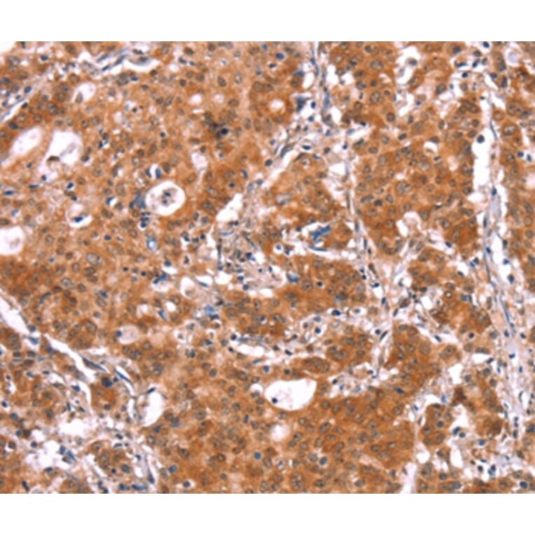 Immunohistochemistry - BCAR1 Antibody from Signalway Antibody (37147) - Antibodies.com