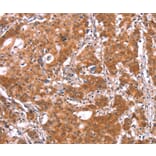 Immunohistochemistry - BCAR1 Antibody from Signalway Antibody (37147) - Antibodies.com