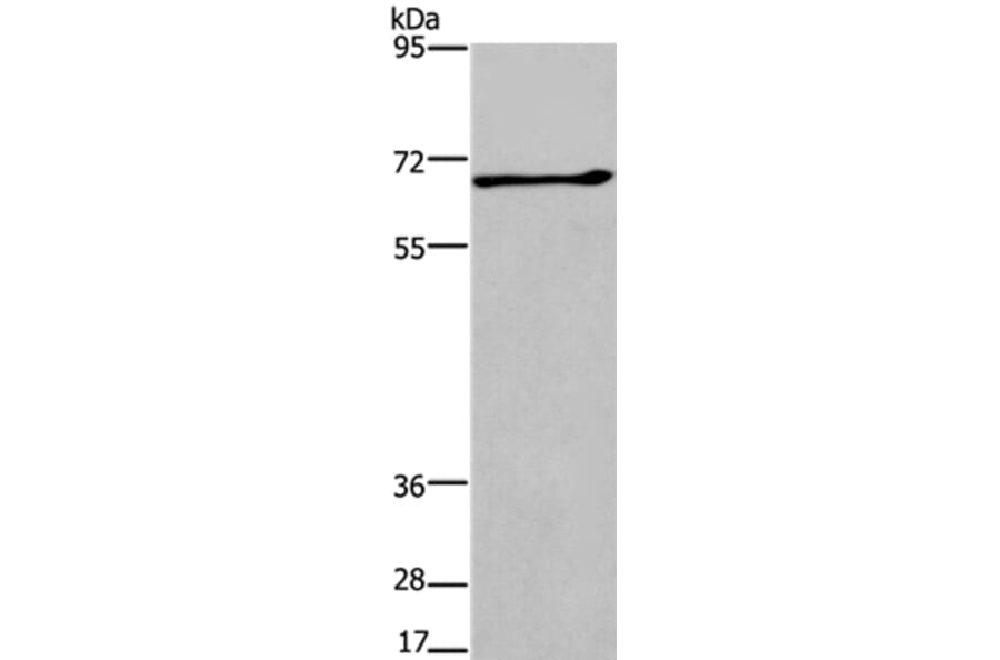 ALCAM Antibody from Signalway Antibody (37158) - Antibodies.com