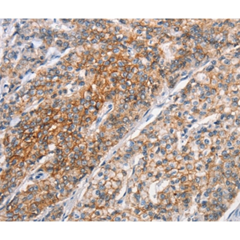 Immunohistochemistry - ALCAM Antibody from Signalway Antibody (37158) - Antibodies.com