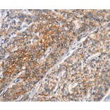 Immunohistochemistry - ALCAM Antibody from Signalway Antibody (37158) - Antibodies.com