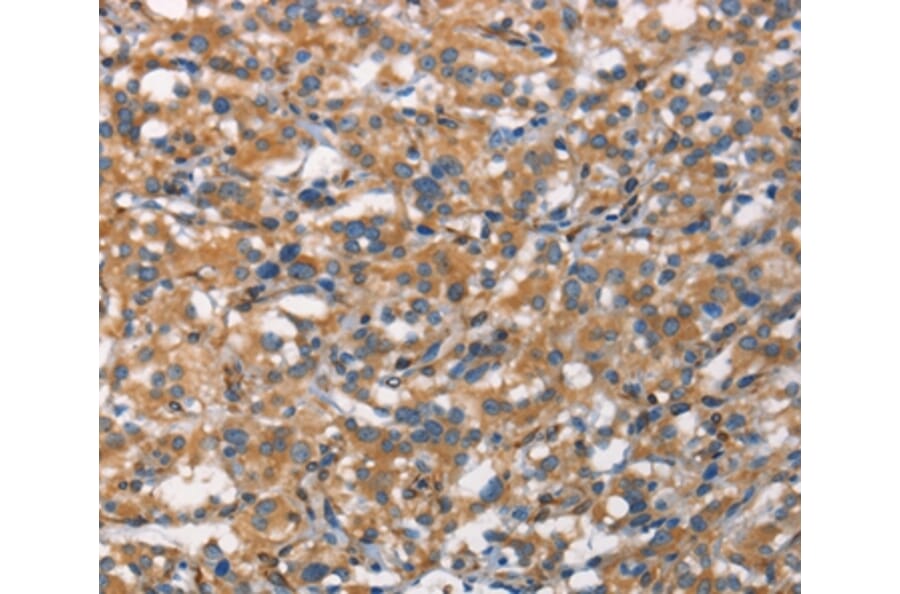 Immunohistochemistry - CDC23 Antibody from Signalway Antibody (37165) - Antibodies.com