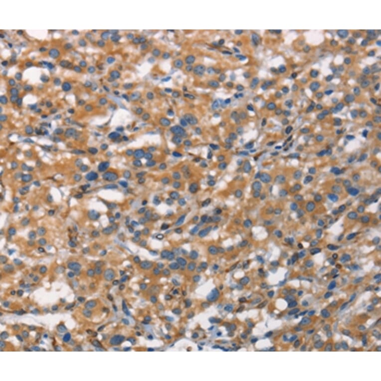 Immunohistochemistry - CDC23 Antibody from Signalway Antibody (37165) - Antibodies.com