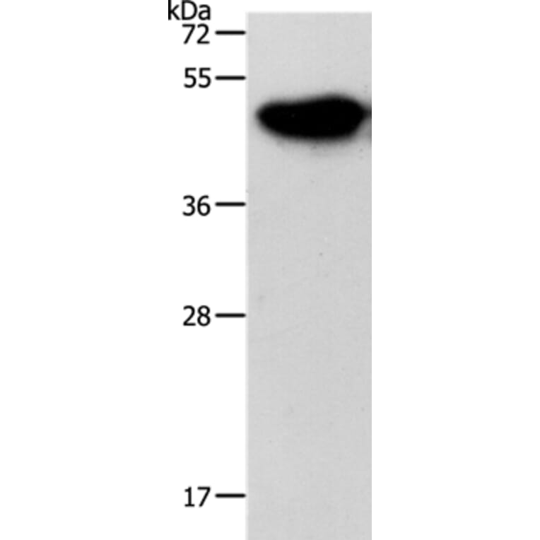 NDRG3 Antibody from Signalway Antibody (37176) - Antibodies.com