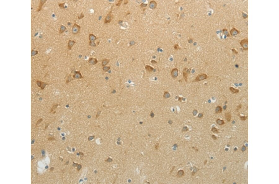 Immunohistochemistry - NDRG3 Antibody from Signalway Antibody (37176) - Antibodies.com