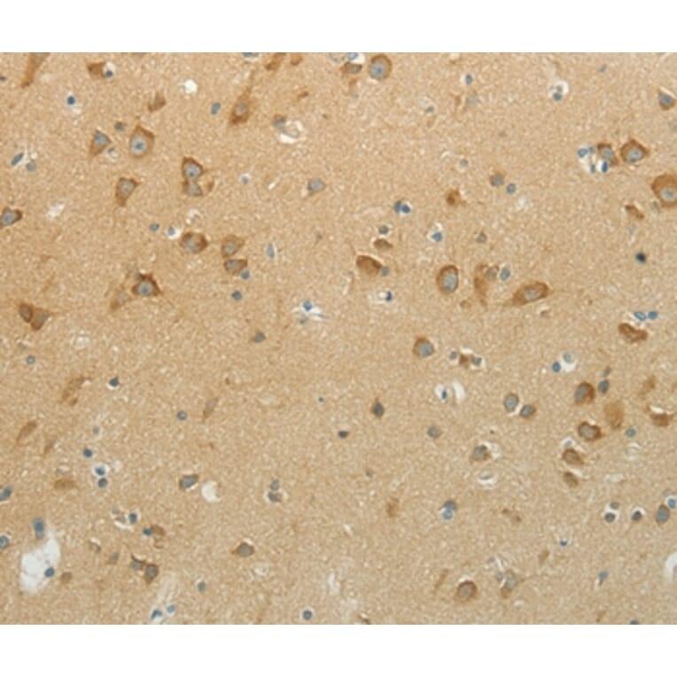 Immunohistochemistry - NDRG3 Antibody from Signalway Antibody (37176) - Antibodies.com