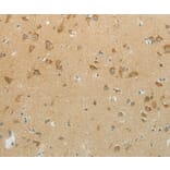 Immunohistochemistry - NDRG3 Antibody from Signalway Antibody (37176) - Antibodies.com