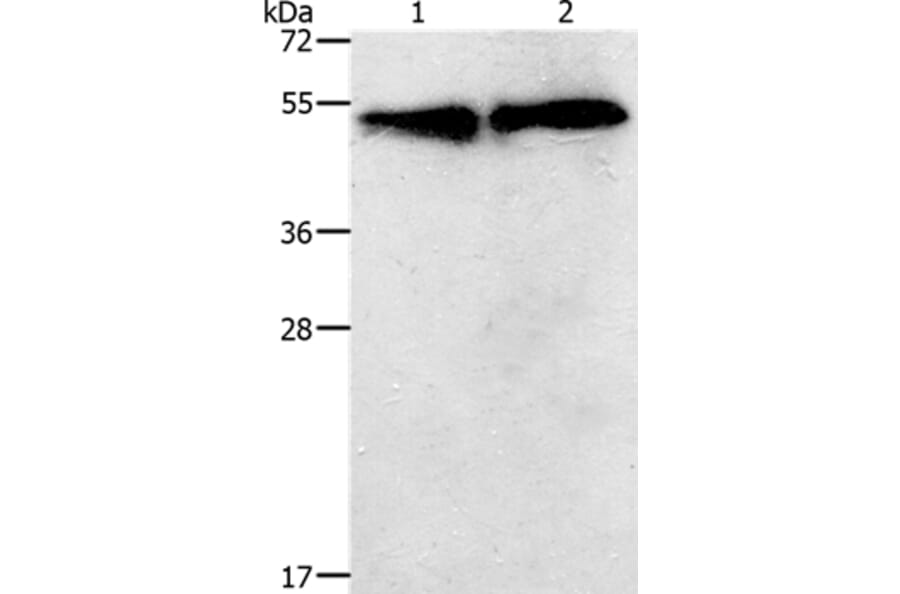 TACR2 Antibody from Signalway Antibody (37189) - Antibodies.com