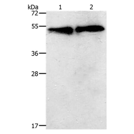 TACR2 Antibody from Signalway Antibody (37189) - Antibodies.com