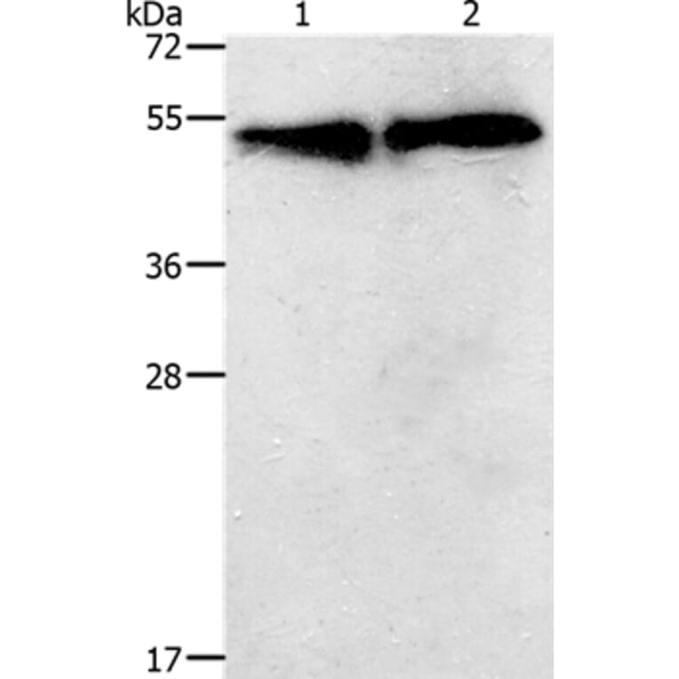 TACR2 Antibody from Signalway Antibody (37189) - Antibodies.com