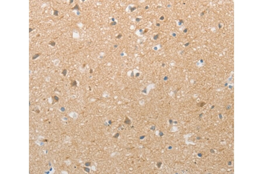 Immunohistochemistry - TACR2 Antibody from Signalway Antibody (37189) - Antibodies.com