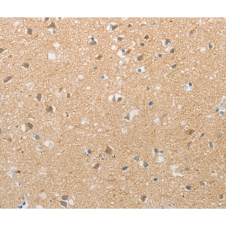 Immunohistochemistry - TACR2 Antibody from Signalway Antibody (37189) - Antibodies.com