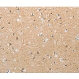 Immunohistochemistry - TACR2 Antibody from Signalway Antibody (37189) - Antibodies.com