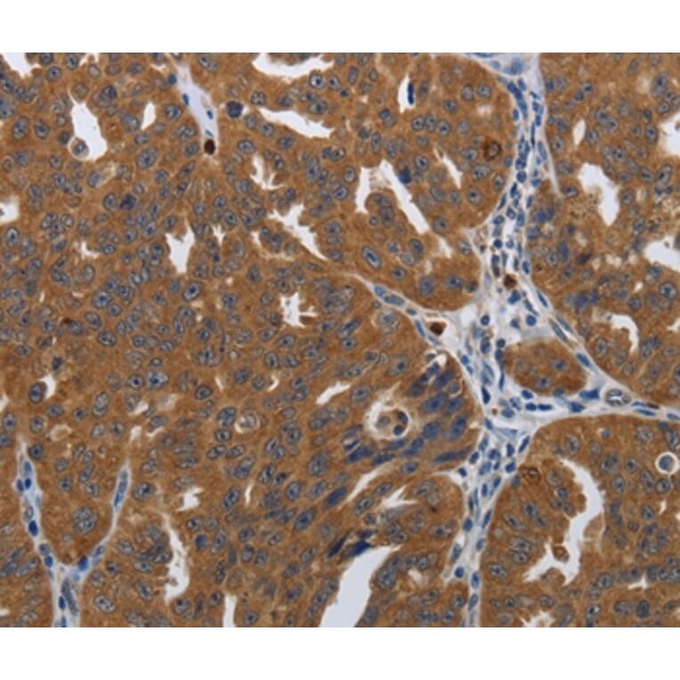 Immunohistochemistry - PDCD2 Antibody from Signalway Antibody (37210) - Antibodies.com