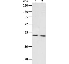 PPARA Antibody from Signalway Antibody (37219) - Antibodies.com